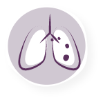 Stage 3A NSCLC Lung Diagram