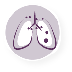 Stage 3C NSCLC Lung Diagram